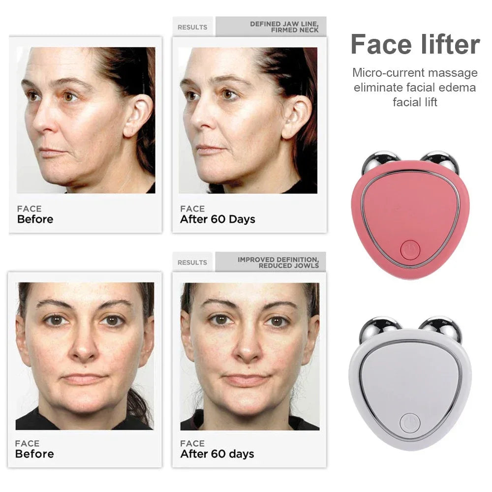 Luna Dea ™ Electric Facial Lifting Roller