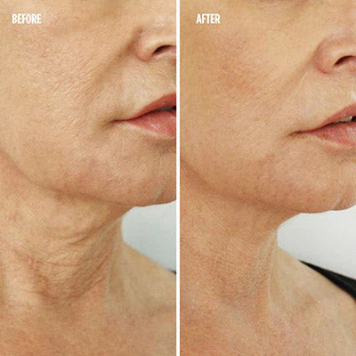 Luna Dea ™ Skin Therapy Wand 4 in 1