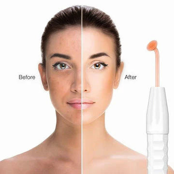 Luna Dea ™ Skin Therapy Wand 4 in 1