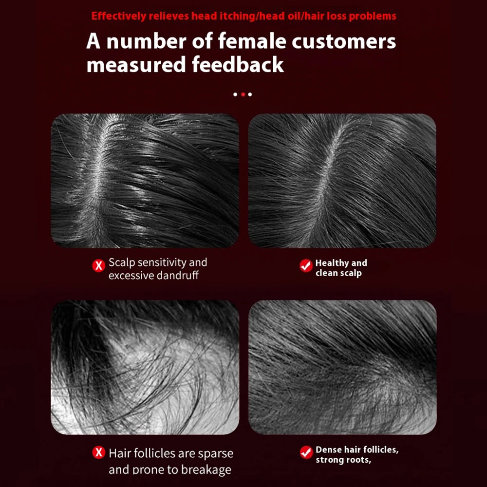Luna Dea ™  Red Light Massage Comb