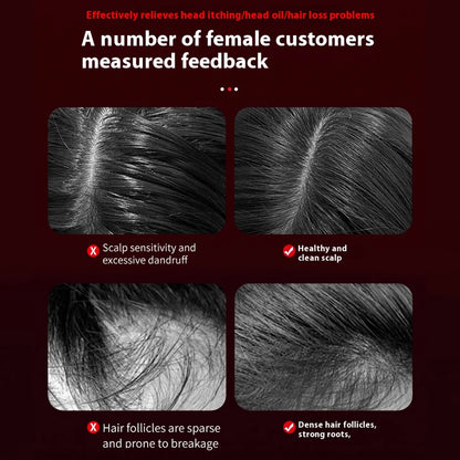 Luna Dea ™  Red Light Massage Comb