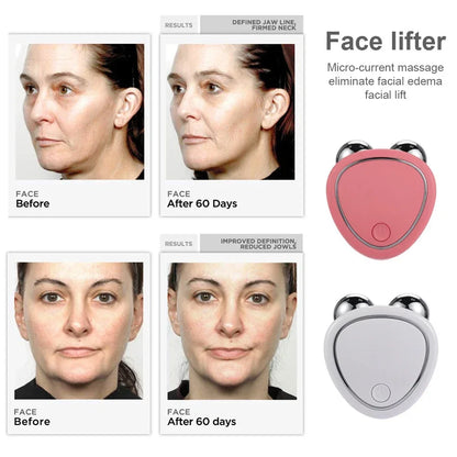 Luna Dea ™ Electric Facial Lifting Roller